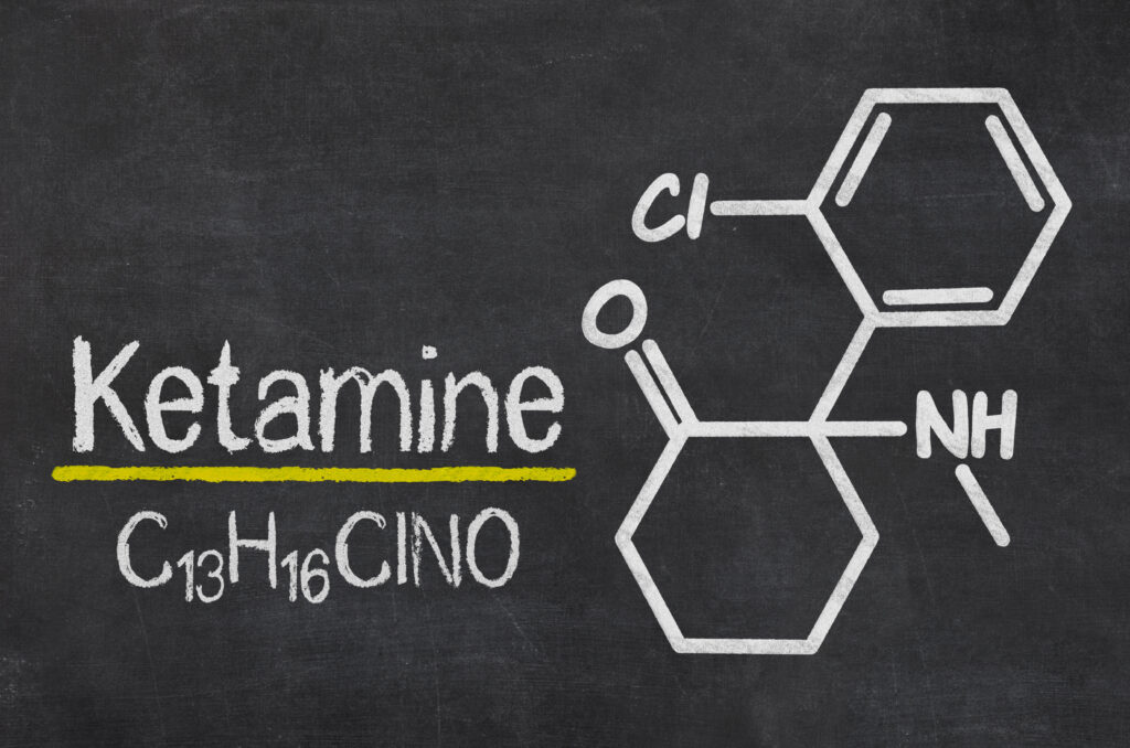 Ketamine-Assisted Retreat for Depression